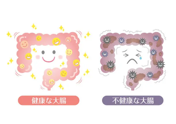健康な腸と不健康な腸